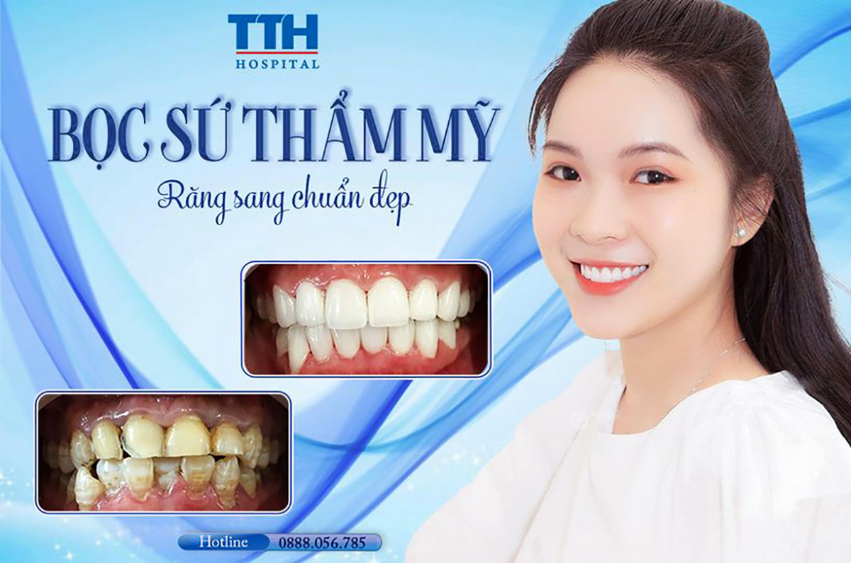 Bọc răng sứ có đau không? Có ảnh hưởng gì không?